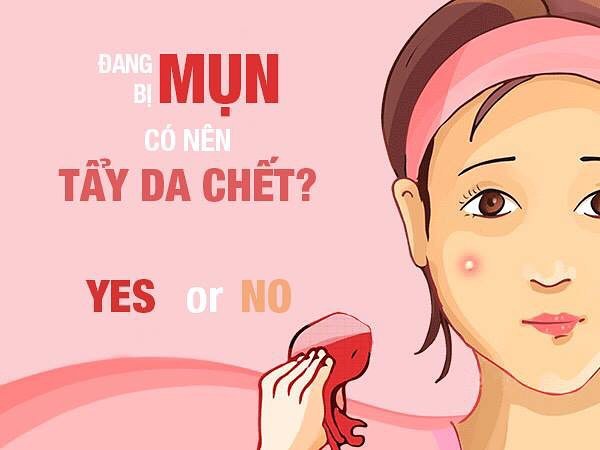 3. Khi nào da mụn nên và không nên tẩy tế bào chết?